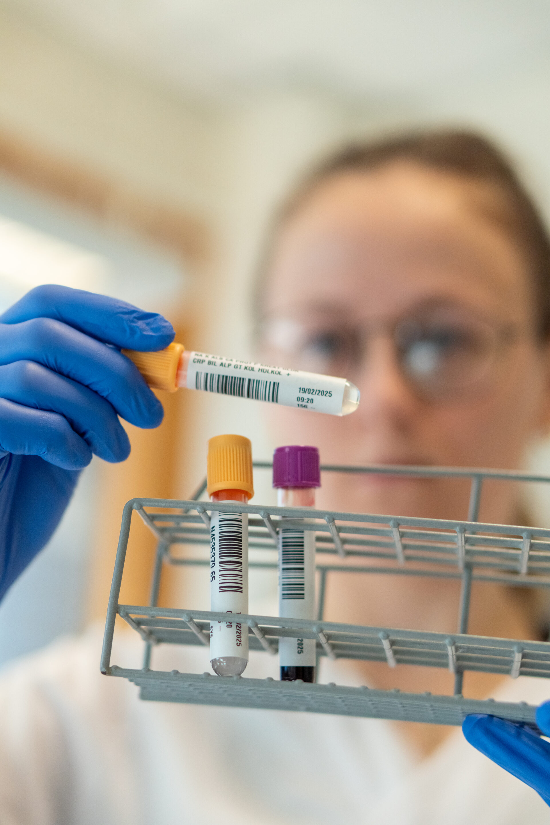 En person med blå hansker og briller holder et reagensrør over et stativ som inneholder flere merkede ampuller, noe som antyder en laboratorie- eller medisinsk testsetting.